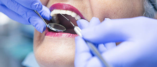 Best Tooth Infection Emergency Dentist  in Beverly Hills, TX